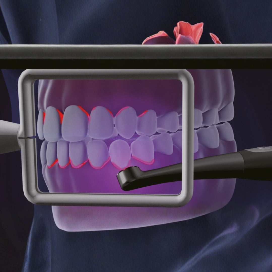 Lámpara de Fotocurado Noblesse A – Max Dental | Ortho Factory México